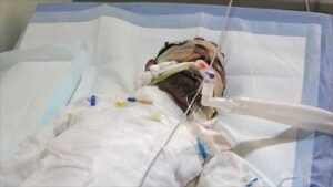نائب محافظ ومدير أمن العاصمة عدن يتفقدا الحالة الصحية للمبسط الذي أحرق نفسه بمديرية الشيخ عثمان