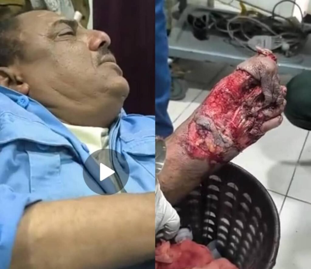 إصابة رجل مرور بحادث دهس في عتق ومناشدات للتدخل العاجل IMG 20260223 WA03731