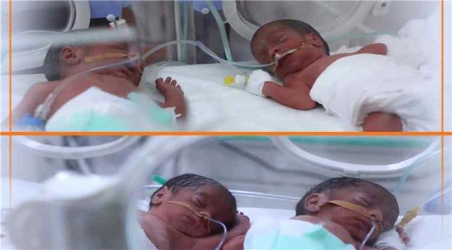 ولادة نادرة لأربعة توائم في مأرب اليمنية والأم والمواليد بصحة جيدة ولادة نادرة لأربعة توائم في مأرب اليمنية والأم والمواليد بصحة جيدة