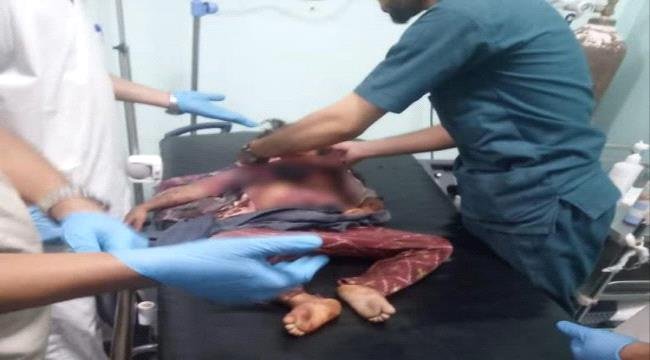 انتقالي محافظة الضالع يطالب بمحاسبة المسؤولين عن مجزرة الريبي انتقالي محافظة الضالع يطالب بمحاسبة المسؤولين عن مجزرة الريبي